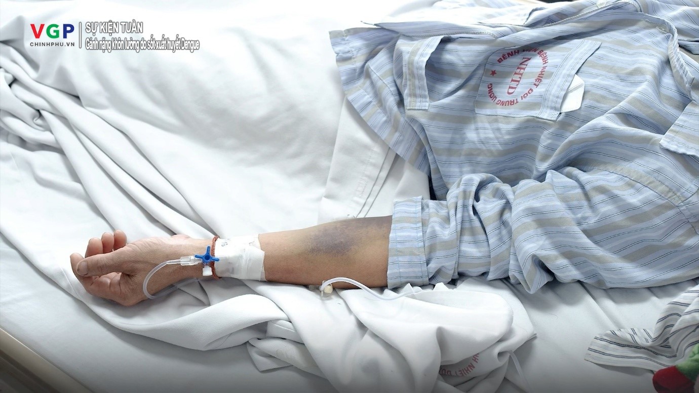 Hiểm họa sốt xuất huyết Dengue: Khi gánh nặng vượt qua những con số- Ảnh 1.