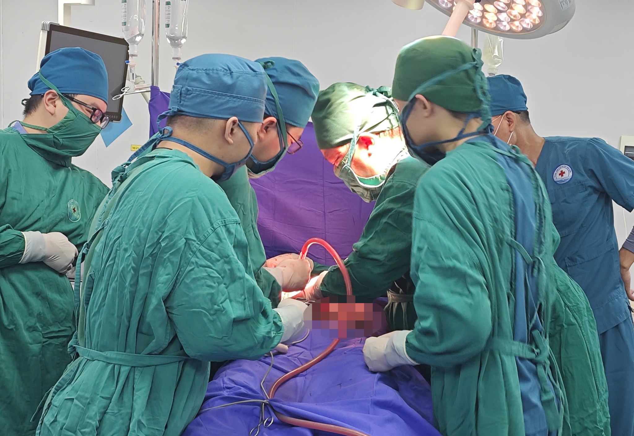 Bác sĩ hiến máu, trực tiếp thực hiện ca mổ cứu sống nam thanh niên bị vỡ thận- Ảnh 1.