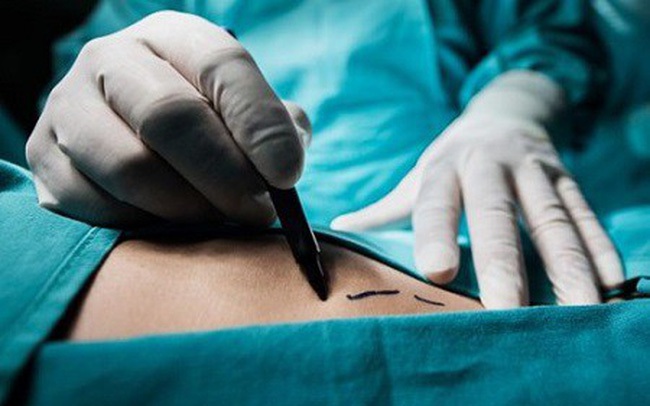 Sửa Luật hiến, ghép mô tạng: Mở rộng nguồn hiến nhưng phải kiểm soát chặt- Ảnh 9.