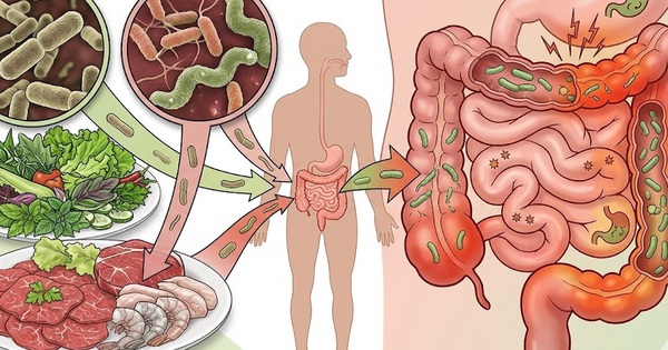 Dễ mắc nhiễm khuẩn đường ruột trong mùa hè từ thói quen ăn đồ sống