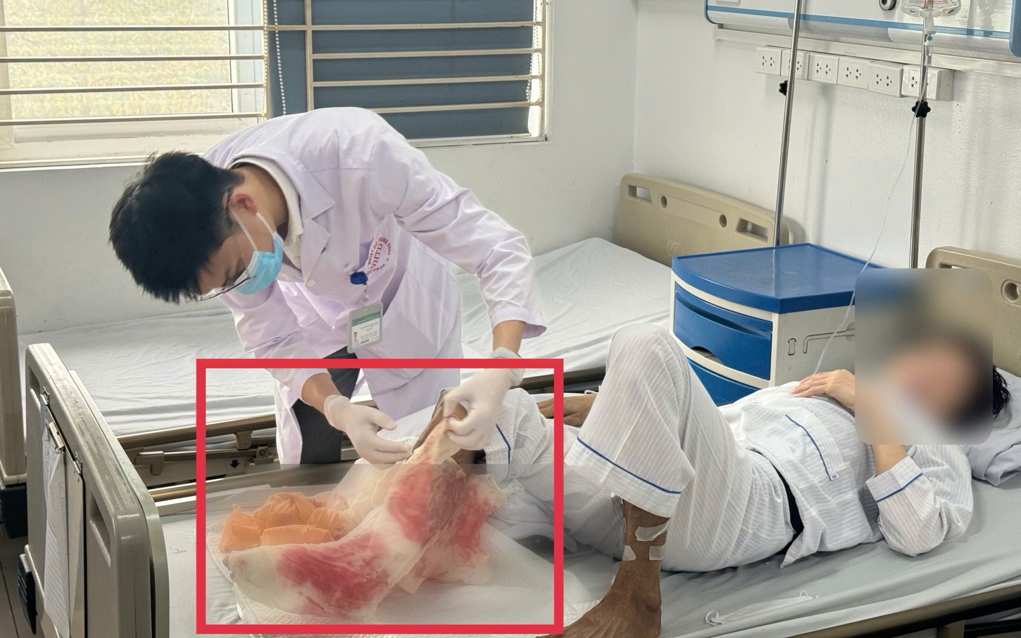 Tưởng viêm họng nhẹ, nữ sinh 16 tuổi nguy kịch do siêu vi khuẩn kháng thuốc tấn công - Ảnh 3.