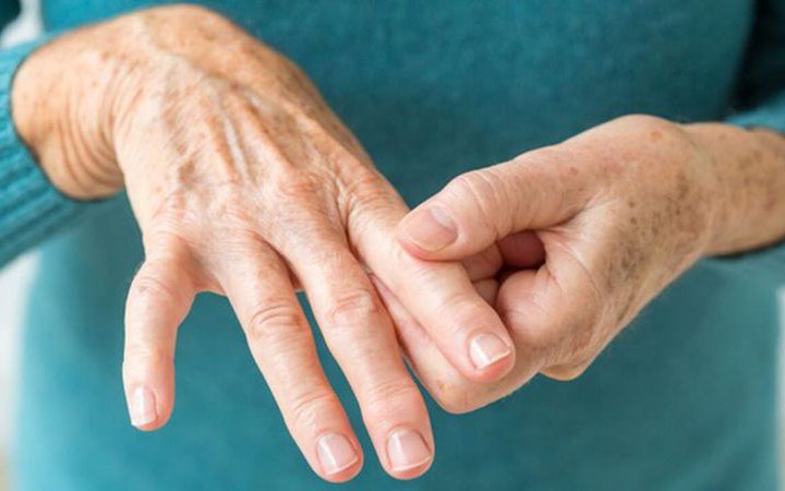 Hội chứng Guillain-Barré dễ bị nhầm với nhiều bệnh lý thần kinh- Ảnh 2.