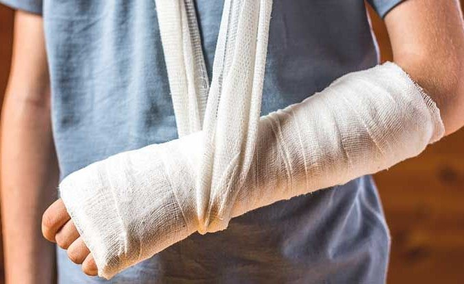 5 dấu hiệu nhận biết gãy xương, những cảnh báo sớm- Ảnh 1. 5 dấu hiệu nhận biết gãy xương, những cảnh báo sớm- Ảnh 1.