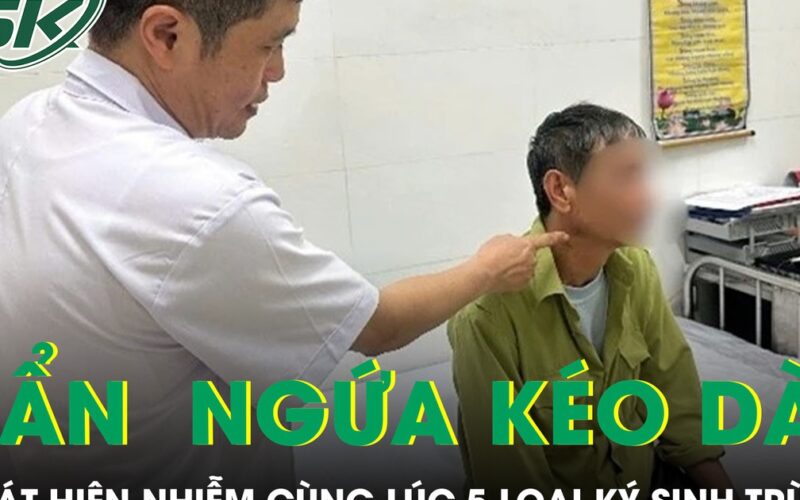 Ngứa suốt nửa năm, người đàn ông phát hiện nhiễm cùng lúc 5 loại ký sinh trùng