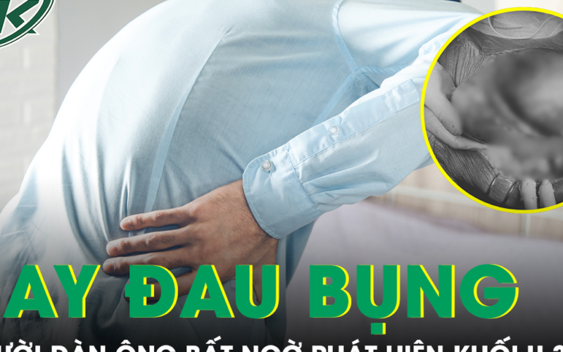 Thỉnh thoảng đau bụng, người đàn ông bất ngờ phát hiện khối u 3kg