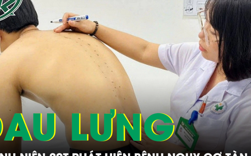 Tưởng đau lưng do tập gym, nam thanh niên 20 tuổi phát hiện mắc bệnh nguy cơ gây tàn phế