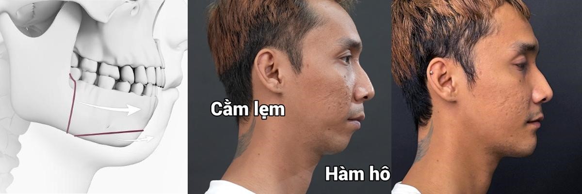 2-1779412103261357668844 Fan ruột Sơn Tùng M-TP 'lột xác' để theo đuổi visual nghệ sĩ- Ảnh 2.