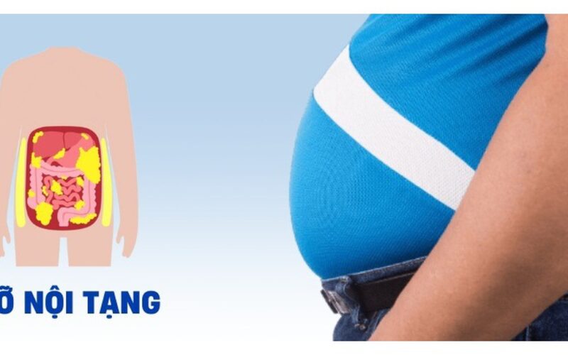 Dư thừa mỡ nội tạng gây nên những bệnh gì?