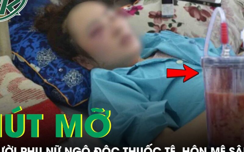 Người phụ nữ 53 tuổi hôn mê sâu, suy hô hấp do ngộ độc thuốc tê ngay sau khi hút mỡ