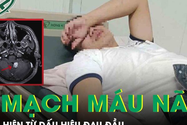 Nam thanh niên phát hiện u mạch máu não xuất huyết từ dấu hiệu đau đầu