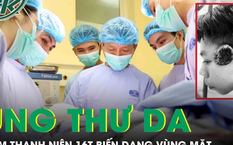 Nam thanh niên 16 tuổi ung thư da vỡ loét, gây biến dạng vùng mặt