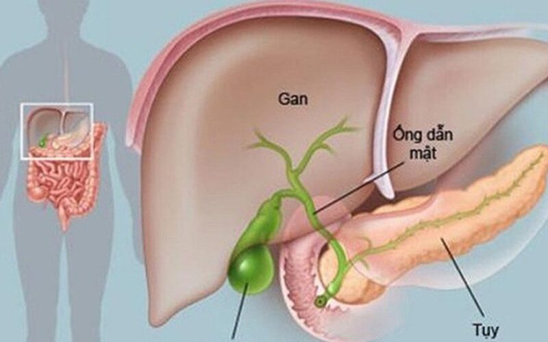 6 dấu hiệu ung thư tụy, nhận biết sớm để điều trị kịp thời