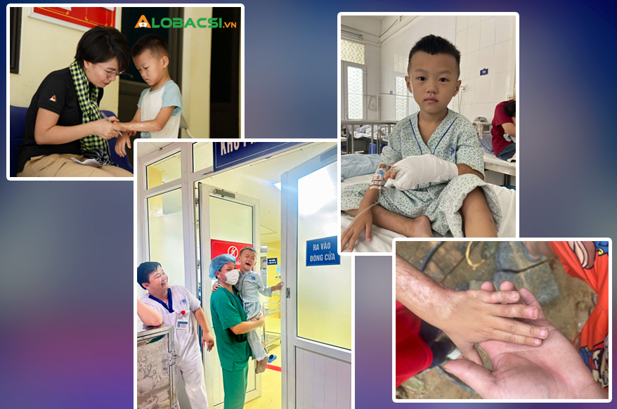 20 năm khoa Phẫu thuật tạo hình, Bệnh viện Xanh Pôn: Chữa lành khuyết hổng, rẽ hướng hàng vạn cuộc đời khiếm khuyết- Ảnh 4.