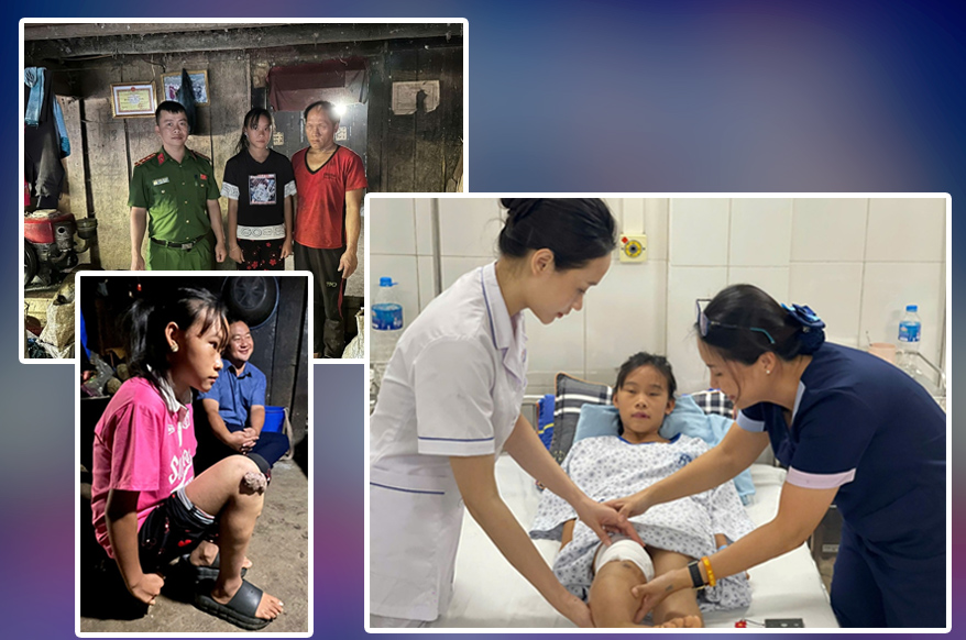 20 năm khoa Phẫu thuật tạo hình, Bệnh viện Xanh Pôn: Chữa lành khuyết hổng, rẽ hướng hàng vạn cuộc đời khiếm khuyết- Ảnh 6.
