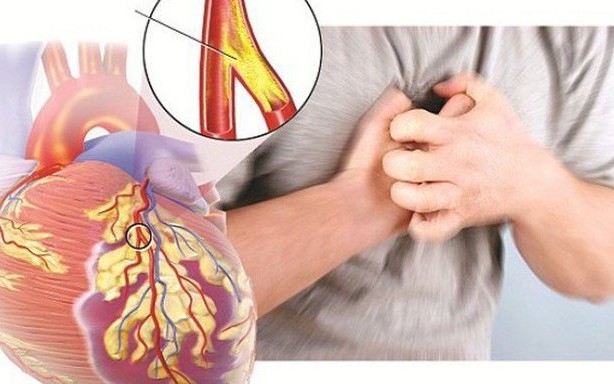 4 cách giảm stress hiệu quả trong môi trường công sở - Ảnh 2.
