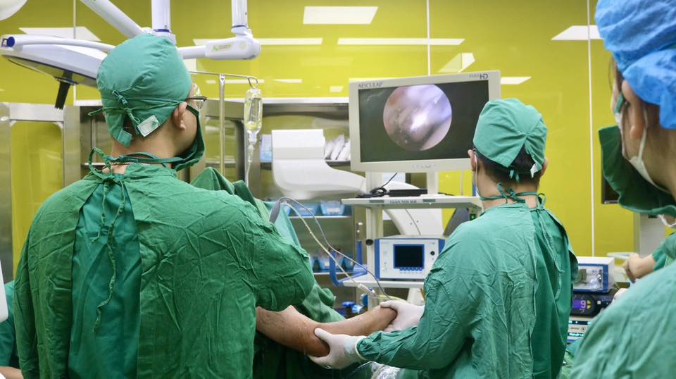 Đau vai kéo dài, đi khám phát hiện bị đứt hoàn toàn cơ trên gai- Ảnh 1.