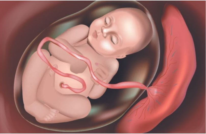 Cảnh báo mẹ bầu bị nhau cài răng lược - Ảnh 1.