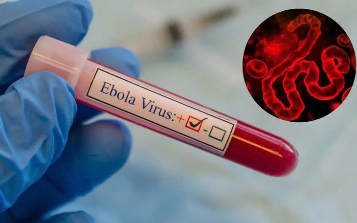 WHO cảnh báo khẩn về Ebola, Bộ Y tế yêu cầu tăng cường giám sát, ngăn dịch xâm nhập