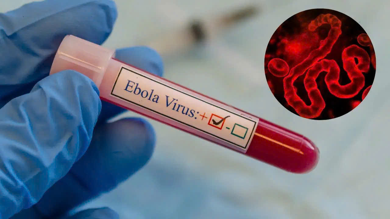 WHO cảnh báo khẩn về Ebola, Bộ Y tế yêu cầu tăng cường giám sát, ngăn dịch xâm nhập- Ảnh 1.