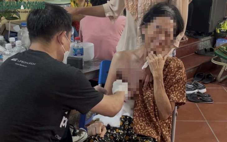 Vụ ông Nguyễn Tiến Nam: Bác sĩ nói gì về việc tự ý mổ u bằng dao điện cao tần?- Ảnh 1.