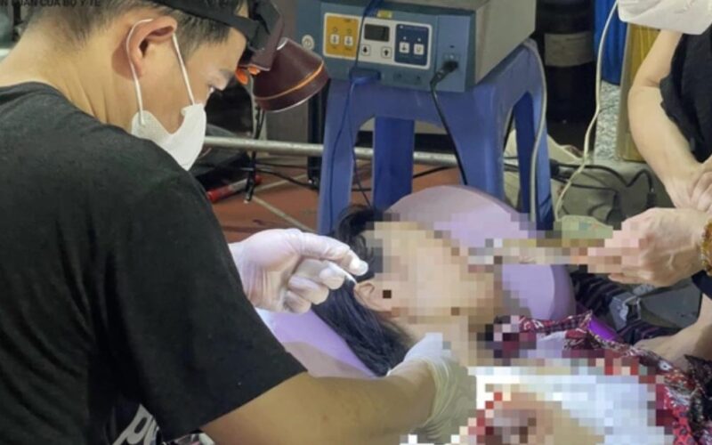 Vụ ông Nguyễn Tiến Nam: Bác sĩ nói gì về việc tự ý mổ u bằng dao điện cao tần?