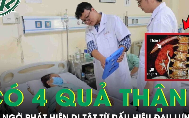 Người phụ nữ bất ngờ phát hiện mình có 4 quả thận từ dấu hiệu đau hông lưng